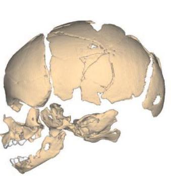 Kaukolė: kaukolės kaulų jungtis. Kaukolės prijungimo tipai