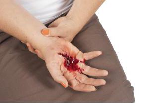 Laikinas kraujavimo sustabdymas - arterinis ir veninis